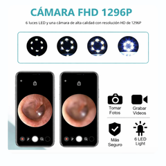 Limpiador de oídos con cámara - APP para celular con visual inteligente inalámbrico
